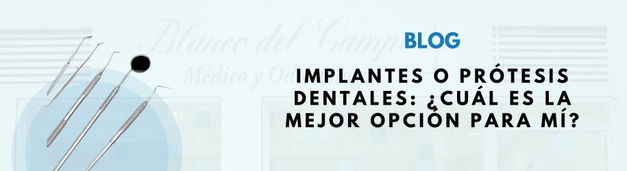 implantes o protesis dentales